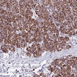 SUCLG2 Antibody, Novus Biologicals 25 &mu;L; Unlabeled:Antibodies, Polyclonal